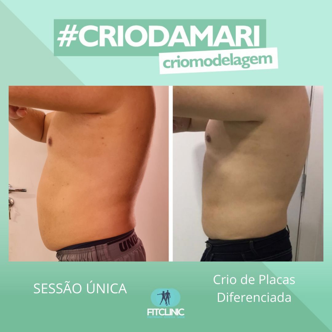 Antes e Depois 01 - Crio da Mari