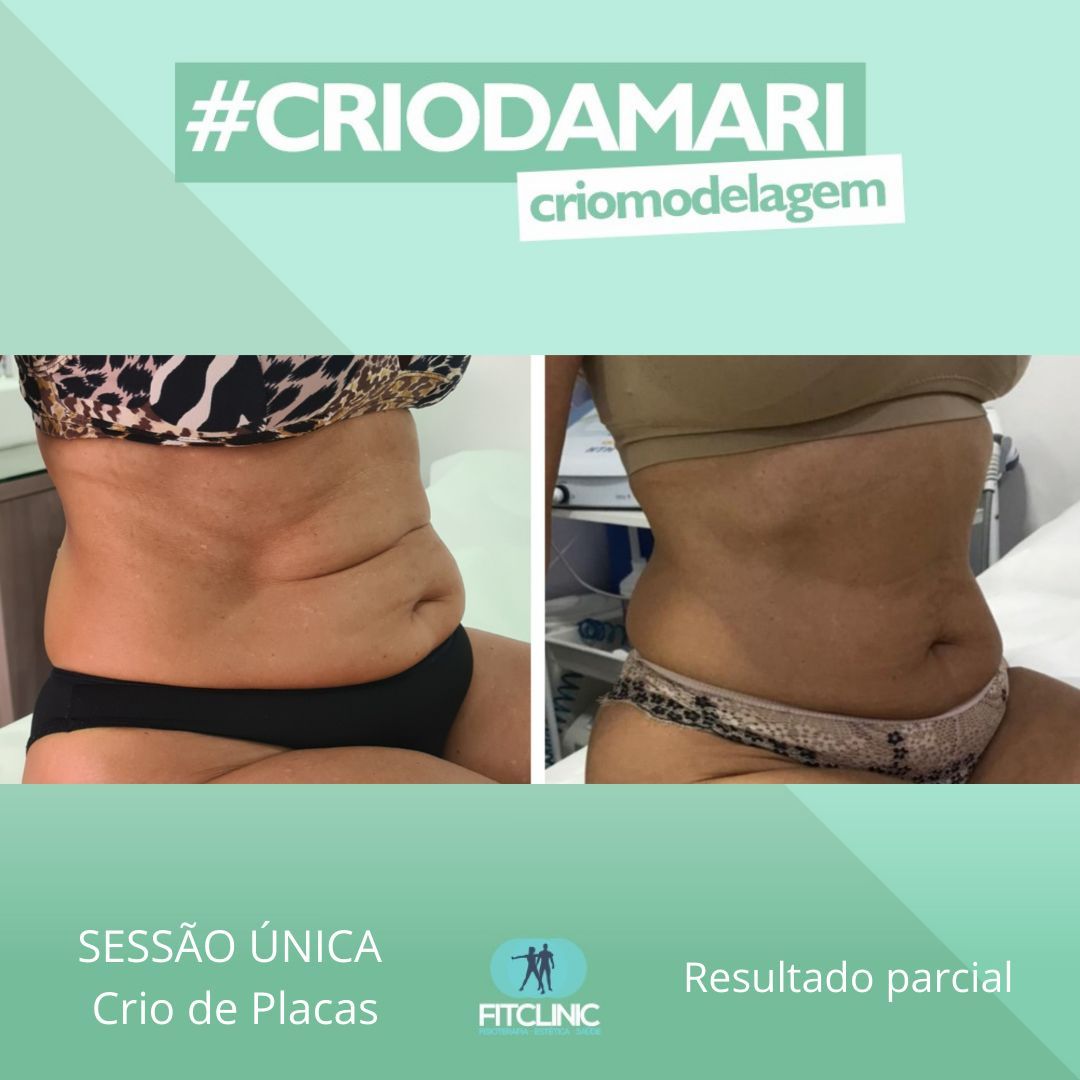 Antes e Depois 11 - Crio da Mari