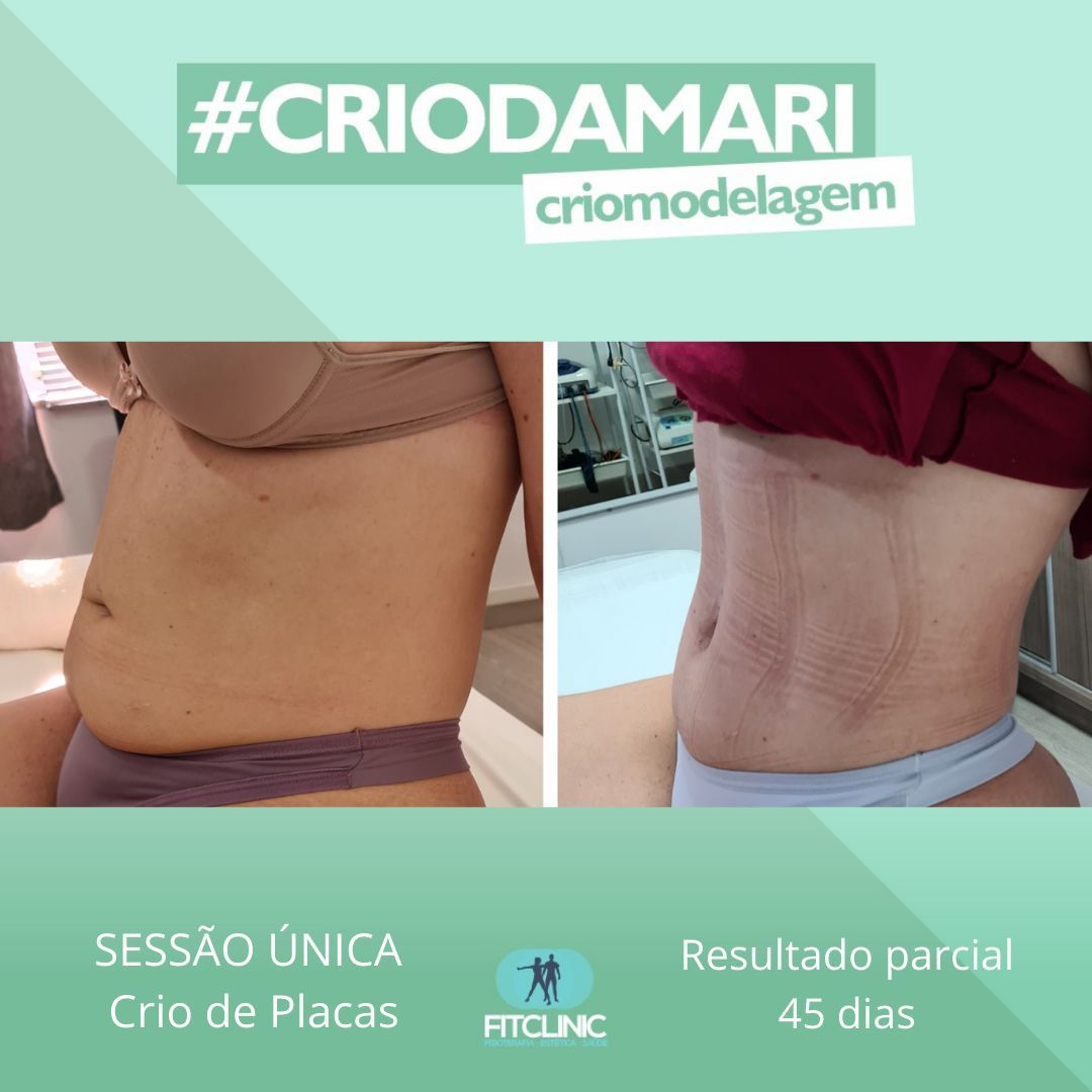 Antes e Depois 1 - Crio da Mari