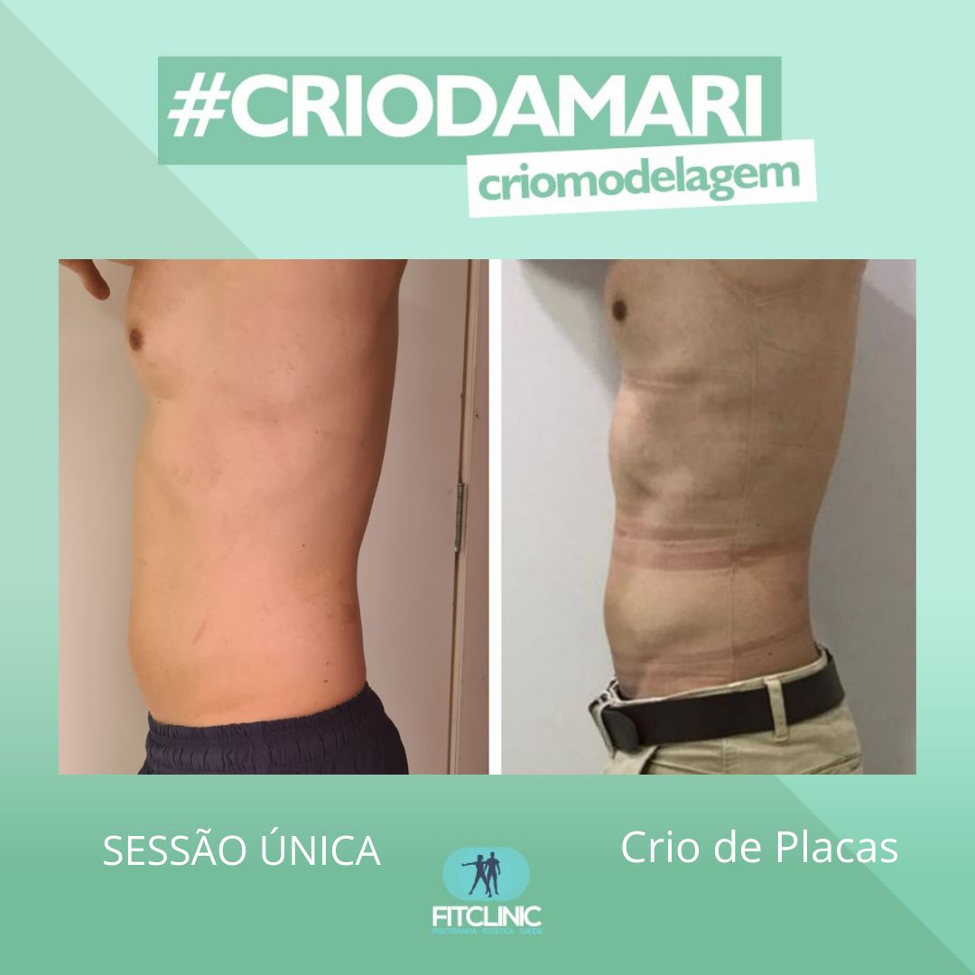 Antes e Depois 12 - Crio da Mari