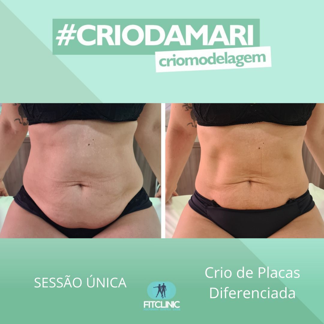 Antes e Depois 2 - Crio da Mari