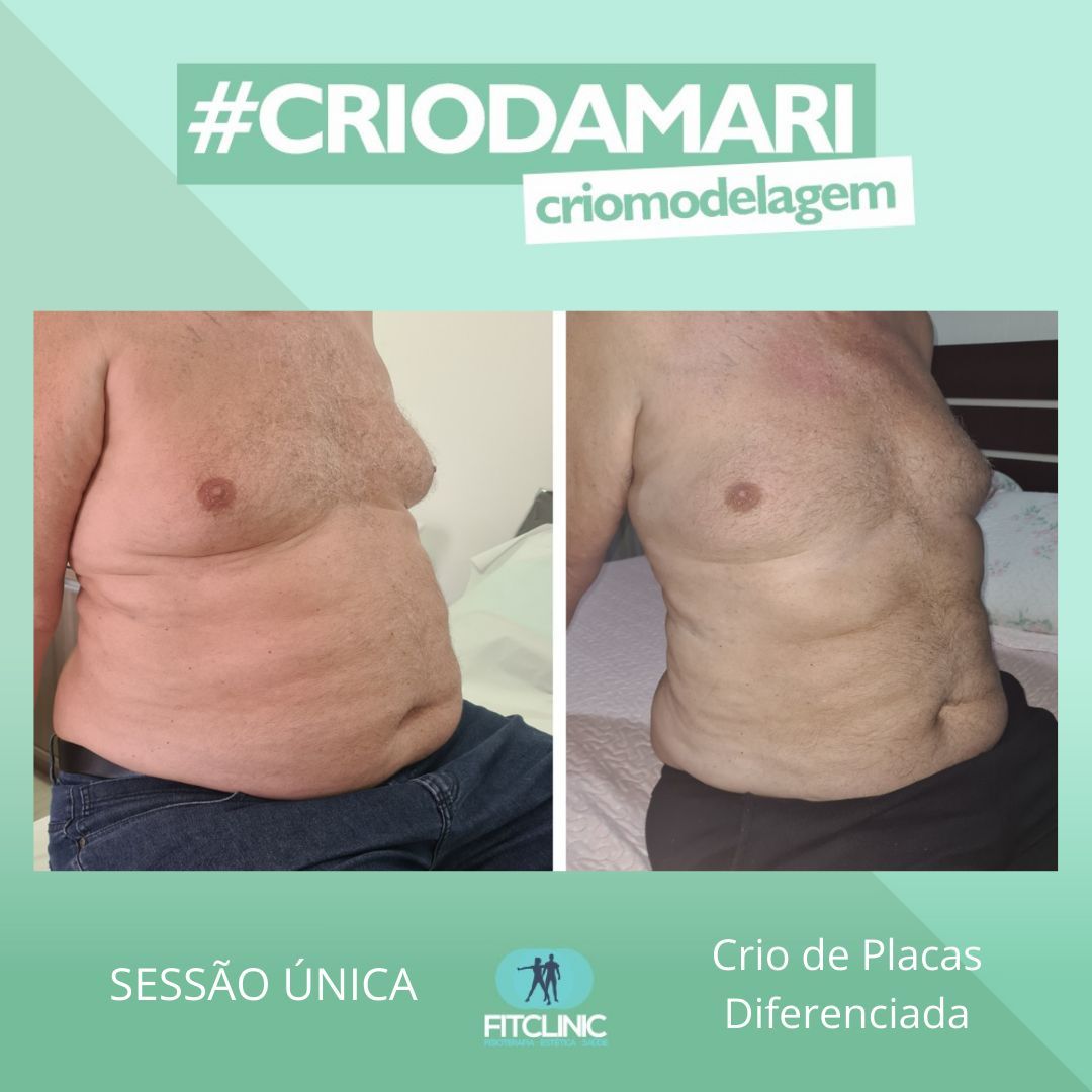 Antes e Depois 03 - Crio da Mari