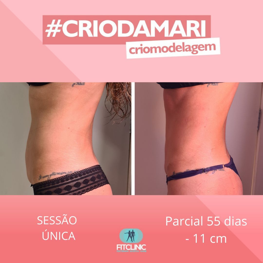 Antes e Depois 14 - Crio da Mari