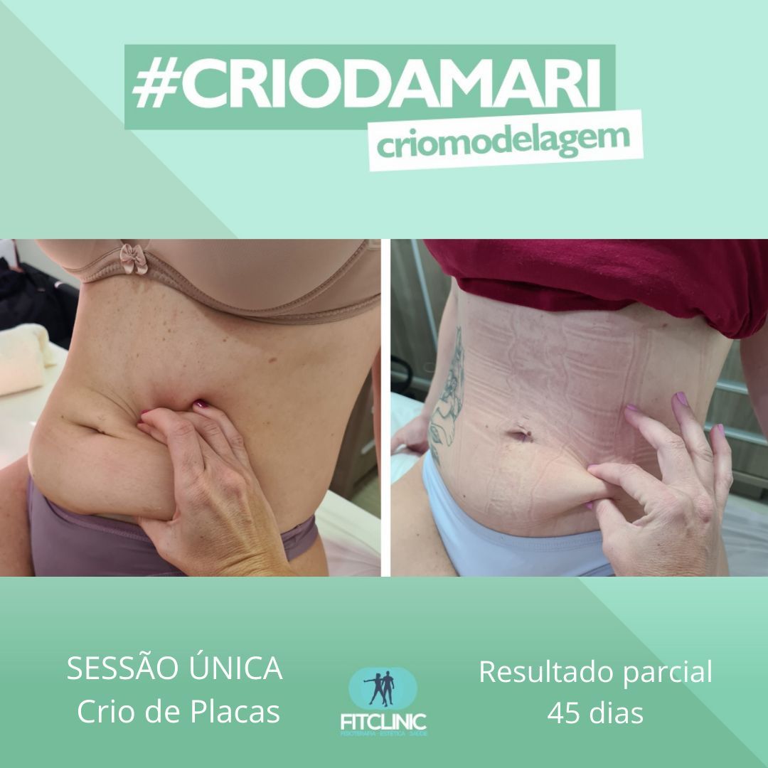 Antes e Depois 05 - Crio da Mari