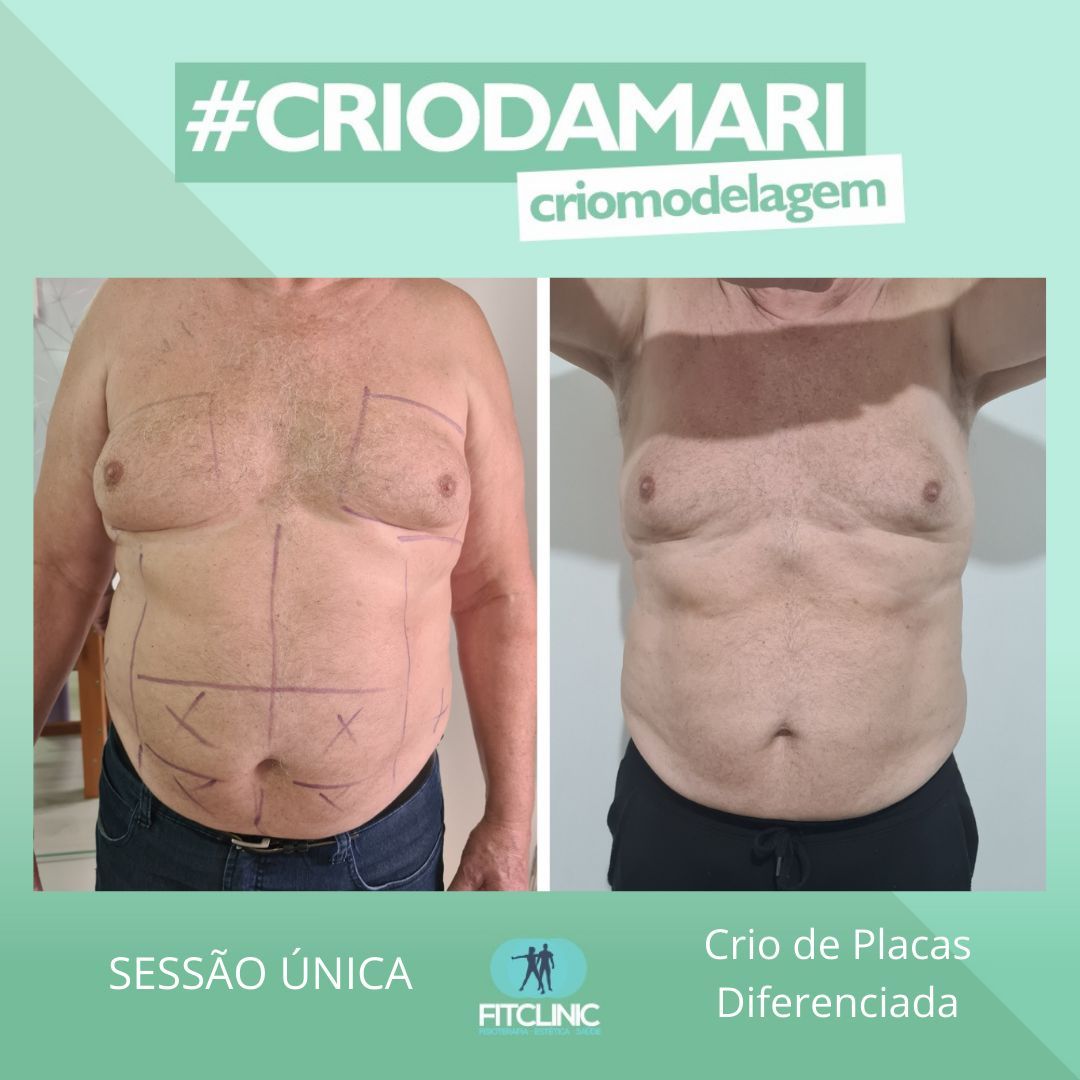 Antes e Depois 5 - Crio da Mari