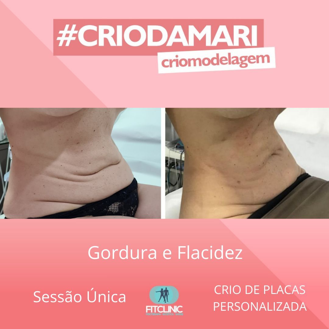 Antes e Depois 16 - Crio da Mari