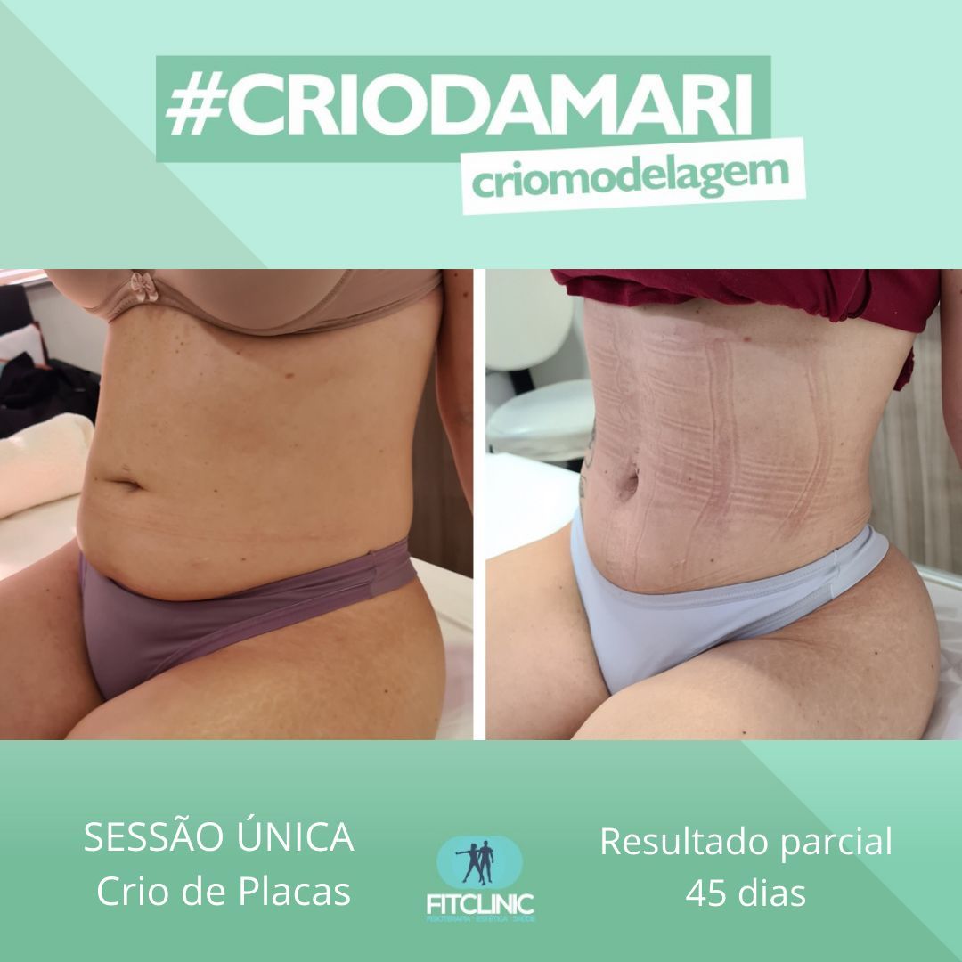 Antes e Depois 06 - Crio da Mari