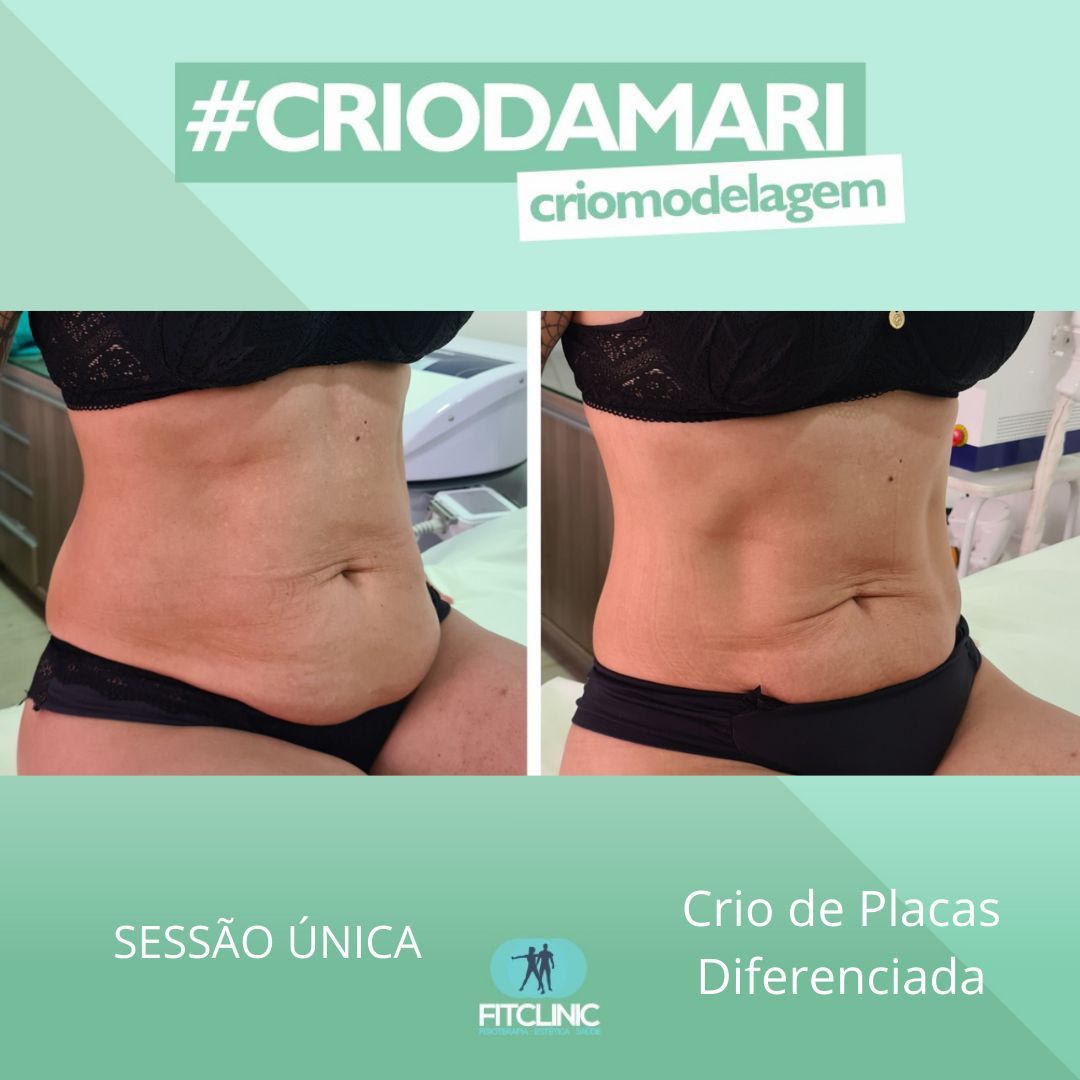 Antes e Depois 17 - Crio da Mari