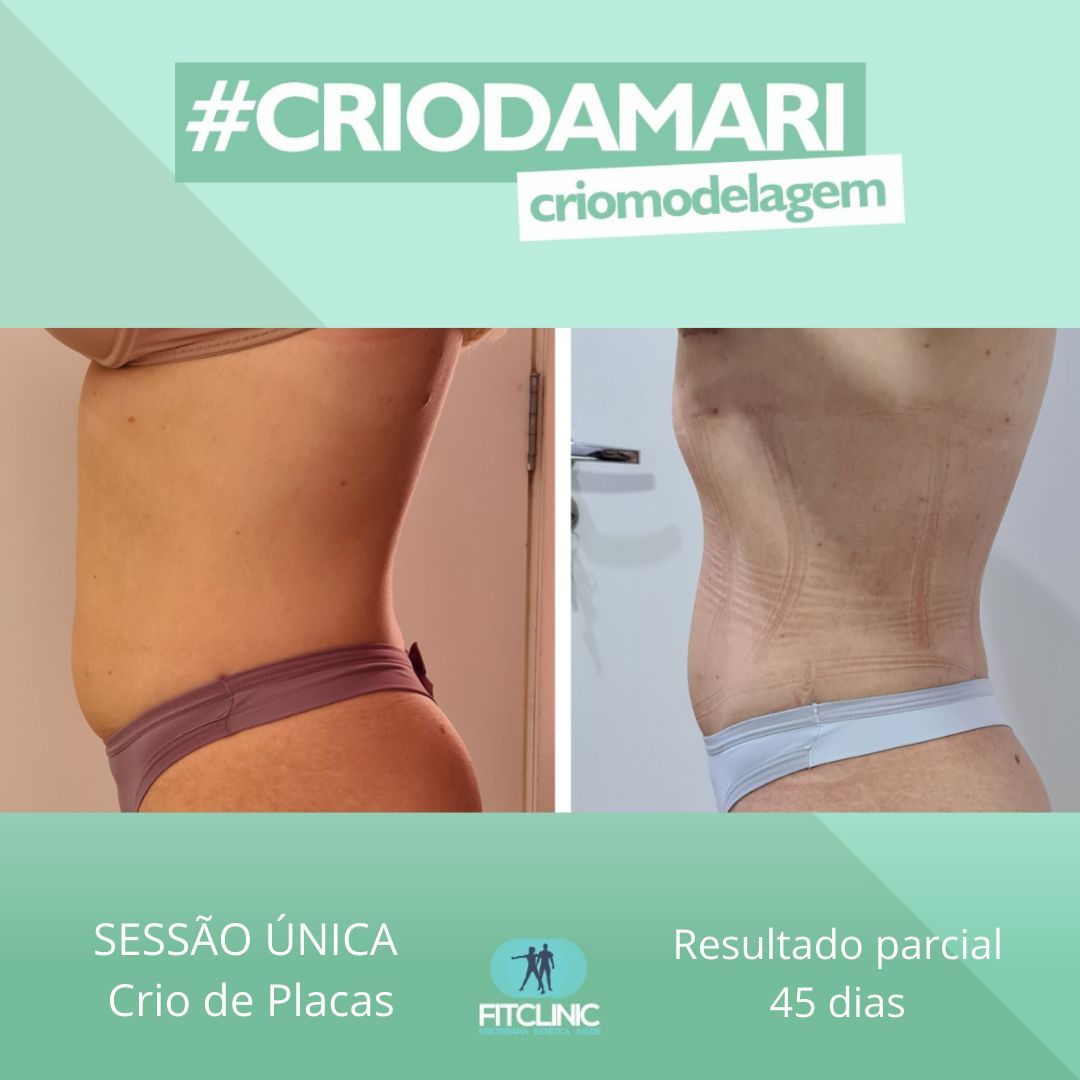 Antes e Depois 07 - Crio da Mari