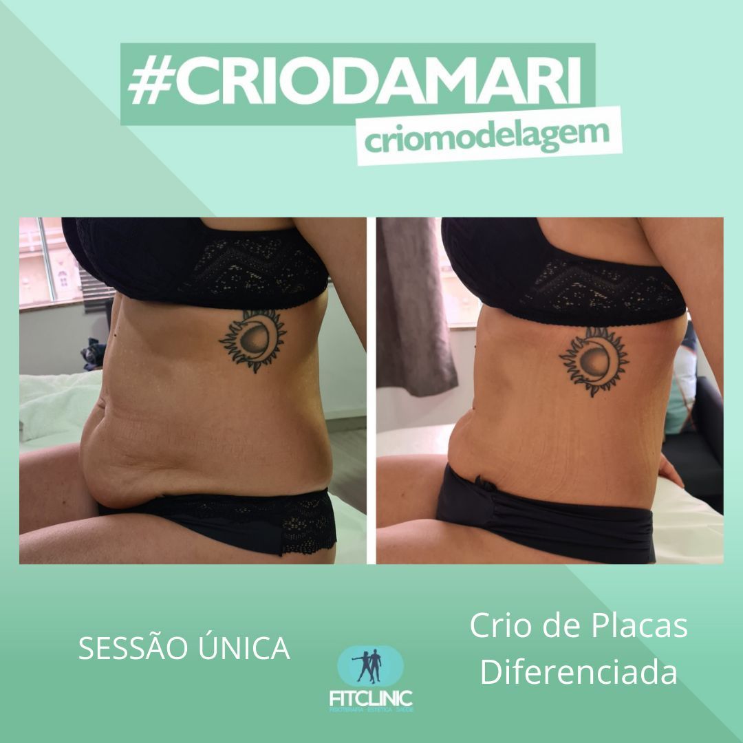 Antes e Depois 18 - Crio da Mari