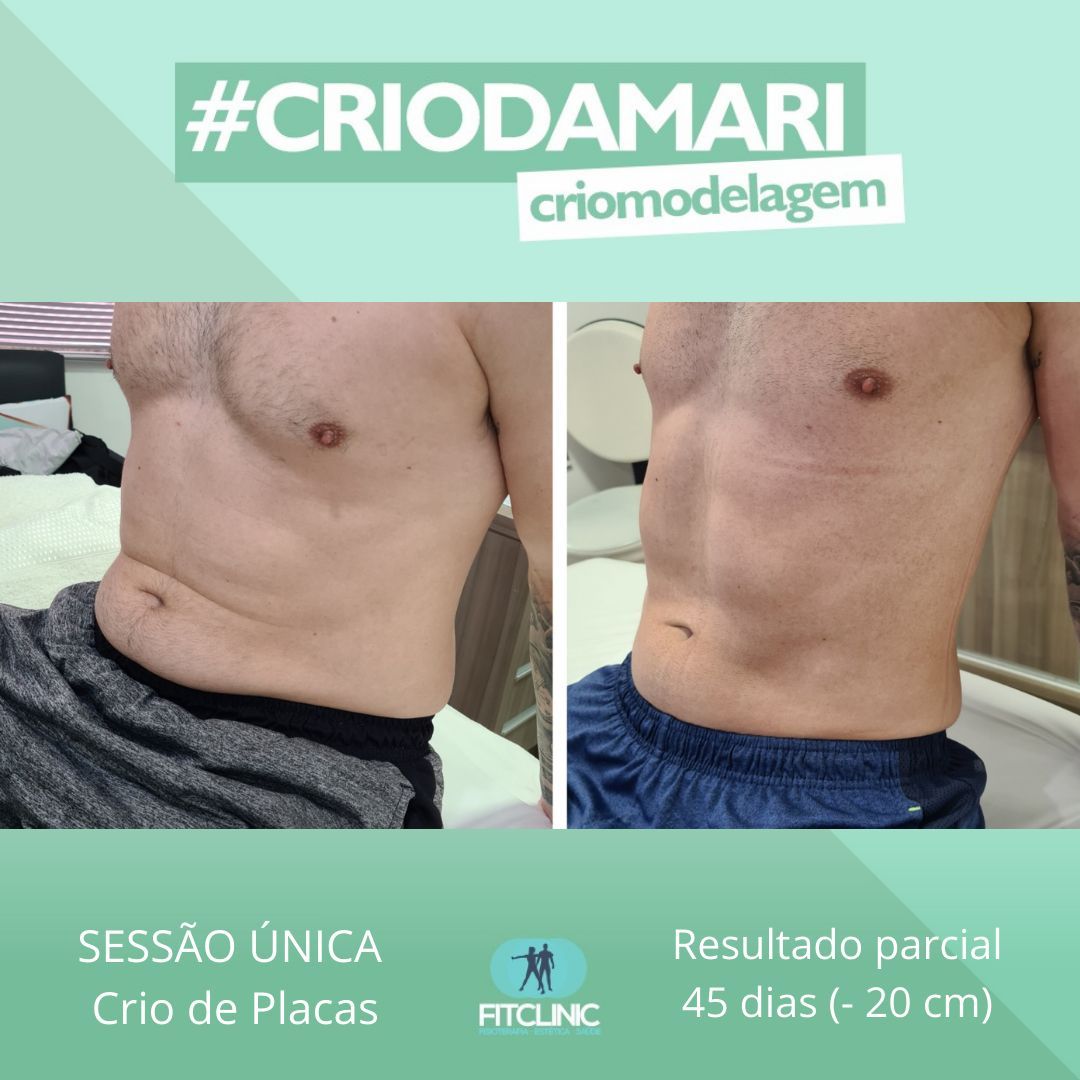 Antes e Depois 08 - Crio da Mari