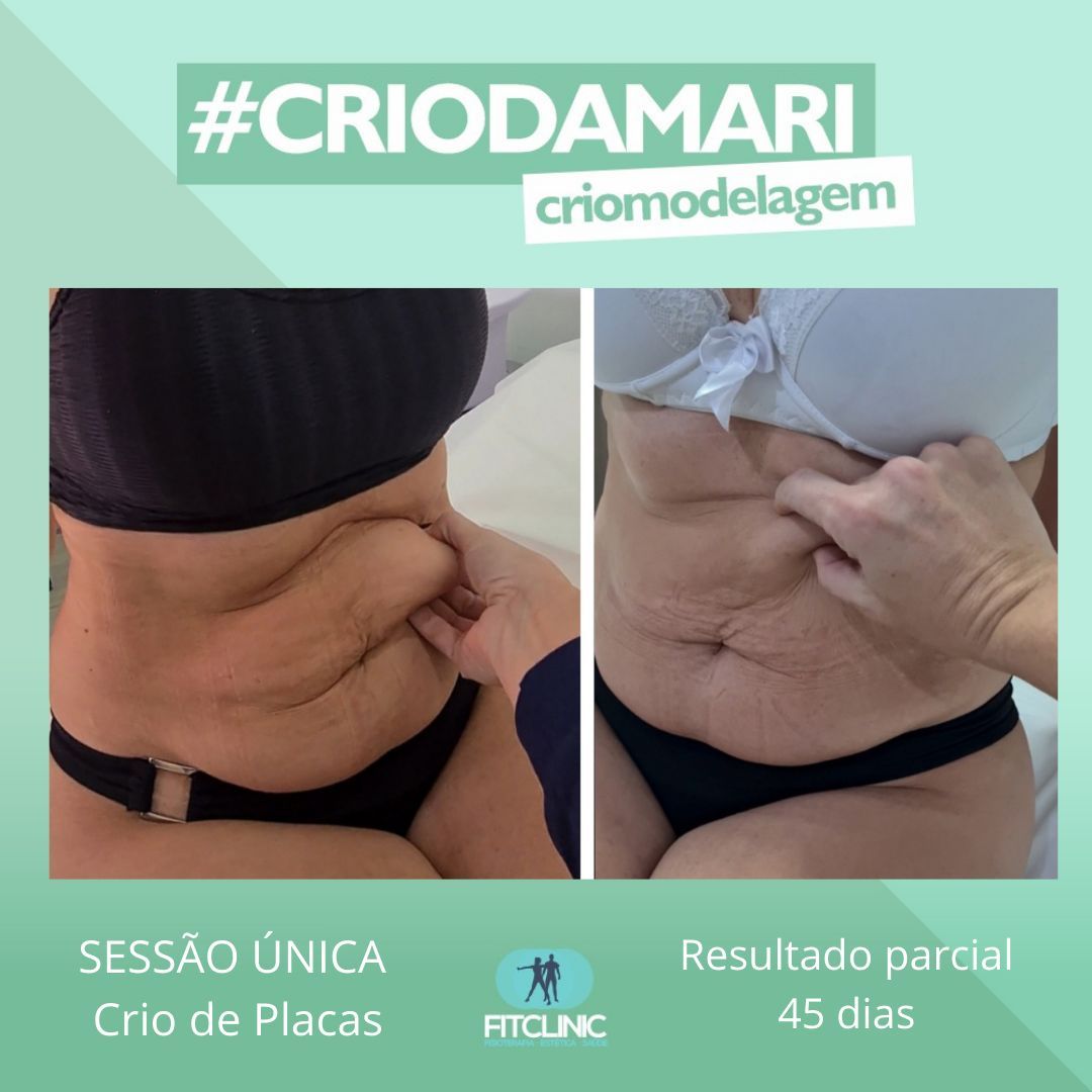 Antes e Depois 09 - Crio da Mari