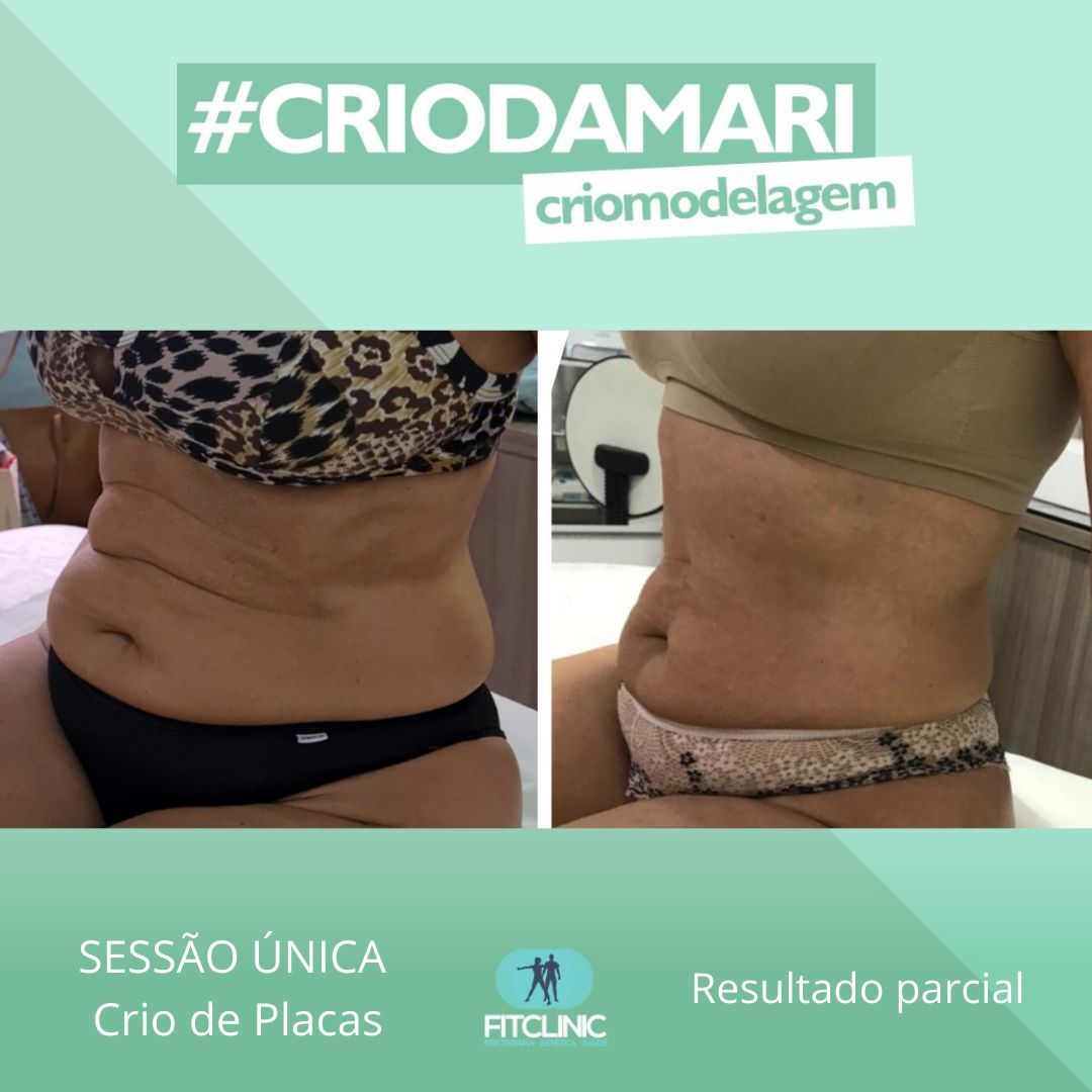 Antes e Depois 10 - Crio da Mari